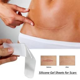 Silicone Gel Sheets for Scars Single Sheet Scar Cover Medical Grade Scar  Prevents Keloid Hypertrophic Scarring