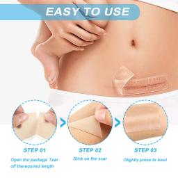 1.5/3M Silicone Scar Tape For Surgical Scars Medical Grade Silicone Scar Sheet Painless Effective Scar Repair Tape