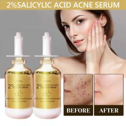 Salicylic Acid 2% Solution Essence Repair Spots Effective Skin Care Beauty Health Moisturizing Shrink Pore Whitening Facial